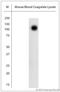 Solute Carrier Family 4 Member 1 (Diego Blood Group) antibody, LS-C829607, Lifespan Biosciences, Western Blot image 