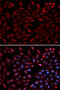 Proteasome 26S Subunit, ATPase 2 antibody, 18-430, ProSci, Immunofluorescence image 