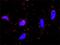 SUFU Negative Regulator Of Hedgehog Signaling antibody, H00051684-M01, Novus Biologicals, Proximity Ligation Assay image 