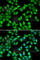 Myosin Light Chain 3 antibody, A6662, ABclonal Technology, Immunofluorescence image 