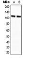Cytosolic carboxypeptidase 2 antibody, orb224124, Biorbyt, Western Blot image 