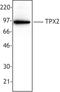 TPX2 Microtubule Nucleation Factor antibody, TA328025, Origene, Western Blot image 