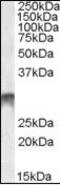 Distal-Less Homeobox 5 antibody, orb95345, Biorbyt, Western Blot image 