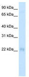 Muscle LIM protein antibody, TA335769, Origene, Western Blot image 