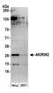 Akirin 2 antibody, A304-968A, Bethyl Labs, Western Blot image 