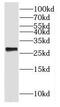 Growth arrest and DNA damage-inducible proteins-interacting protein 1 antibody, FNab03296, FineTest, Western Blot image 