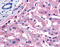 Solute Carrier Family 5 Member 4 antibody, TA317341, Origene, Immunohistochemistry frozen image 