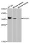 Serine Protease 1 antibody, abx001154, Abbexa, Western Blot image 
