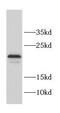 Coiled-Coil Domain Containing 12 antibody, FNab01346, FineTest, Western Blot image 