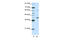 Zinc Finger Protein 843 antibody, 29-189, ProSci, Enzyme Linked Immunosorbent Assay image 