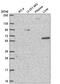 Condensin-2 complex subunit H2 antibody, HPA067932, Atlas Antibodies, Western Blot image 