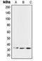 Surfactant Protein A2 antibody, LS-C353690, Lifespan Biosciences, Western Blot image 