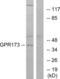 Probable G-protein coupled receptor 173 antibody, abx015313, Abbexa, Western Blot image 