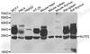 Nuclear Transport Factor 2 antibody, A7057, ABclonal Technology, Western Blot image 