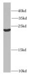 Heat Shock Protein Nuclear Import Factor Hikeshi antibody, FNab03864, FineTest, Western Blot image 