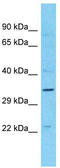 MAGE Family Member B10 antibody, TA337424, Origene, Western Blot image 