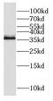 Probable rRNA-processing protein EBP2 antibody, FNab02616, FineTest, Western Blot image 
