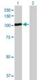 LAS1 Like, Ribosome Biogenesis Factor antibody, H00081887-B01P, Novus Biologicals, Western Blot image 