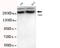 Chromodomain Helicase DNA Binding Protein 3 antibody, TA346915, Origene, Western Blot image 