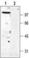 Potassium Voltage-Gated Channel Subfamily C Member 2 antibody, TA328930, Origene, Western Blot image 