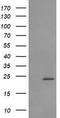 RAB30, Member RAS Oncogene Family antibody, TA505317AM, Origene, Western Blot image 
