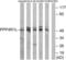 Putative serine/threonine-protein phosphatase 4 regulatory subunit 1-like antibody, LS-C120379, Lifespan Biosciences, Western Blot image 