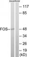 Proto-oncogene c-Fos antibody, TA312212, Origene, Western Blot image 