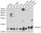 NADH:Ubiquinone Oxidoreductase Subunit A5 antibody, GTX33349, GeneTex, Western Blot image 