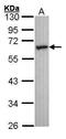 5-Hydroxytryptamine Receptor 2C antibody, PA5-27164, Invitrogen Antibodies, Western Blot image 