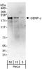 Centromere Protein J antibody, A302-986A, Bethyl Labs, Western Blot image 