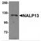 NLR Family Pyrin Domain Containing 13 antibody, MBS150278, MyBioSource, Western Blot image 