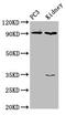 CD11A antibody, CSB-PA05204A0Rb, Cusabio, Western Blot image 