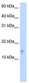 Vesicle Associated Membrane Protein 5 antibody, TA341852, Origene, Western Blot image 