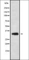 Neugrin, Neurite Outgrowth Associated antibody, orb338476, Biorbyt, Western Blot image 