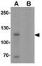 Myelin Transcription Factor 1 Like antibody, GTX31505, GeneTex, Western Blot image 