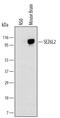 SEZ6L2 antibody, MA5-24231, Invitrogen Antibodies, Western Blot image 