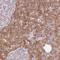 Ribosomal Protein L18a antibody, HPA055259, Atlas Antibodies, Immunohistochemistry paraffin image 