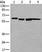 UTP18 Small Subunit Processome Component antibody, PA5-67632, Invitrogen Antibodies, Western Blot image 