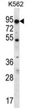 ATP Binding Cassette Subfamily D Member 2 antibody, AP50019PU-N, Origene, Western Blot image 
