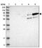 E3 ubiquitin-protein ligase AMFR antibody, PA5-56038, Invitrogen Antibodies, Western Blot image 
