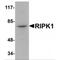 Receptor Interacting Serine/Threonine Kinase 1 antibody, MBS150077, MyBioSource, Western Blot image 