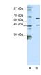 Zinc Finger Protein 597 antibody, NBP1-80408, Novus Biologicals, Western Blot image 