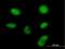 Zinc Finger CCHC-Type Containing 13 antibody, H00389874-B01P, Novus Biologicals, Immunofluorescence image 