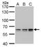 Pre-MRNA Processing Factor 31 antibody, PA5-78466, Invitrogen Antibodies, Western Blot image 