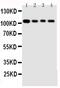 Heat Shock Protein Family H (Hsp110) Member 1 antibody, PA5-79418, Invitrogen Antibodies, Western Blot image 