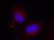 Protein Tyrosine Kinase 2 antibody, orb14844, Biorbyt, Immunofluorescence image 