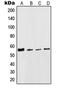 Keratin 8 antibody, MBS821673, MyBioSource, Western Blot image 