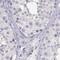 Cone-Rod Homeobox antibody, NBP1-88059, Novus Biologicals, Immunohistochemistry paraffin image 