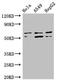 Uncharacterized aarF domain-containing protein kinase 4 antibody, CSB-PA839305LA01HU, Cusabio, Western Blot image 