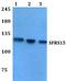 SR-Related CTD Associated Factor 4 antibody, A10224-2, Boster Biological Technology, Western Blot image 